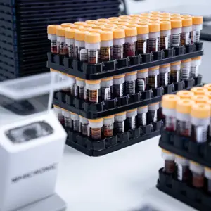 Voorbereiding - Bloedbuisjes voor bio bank